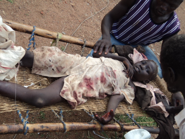 Nuba Mountains war crime victims